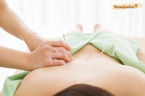 beneficios acupuntura